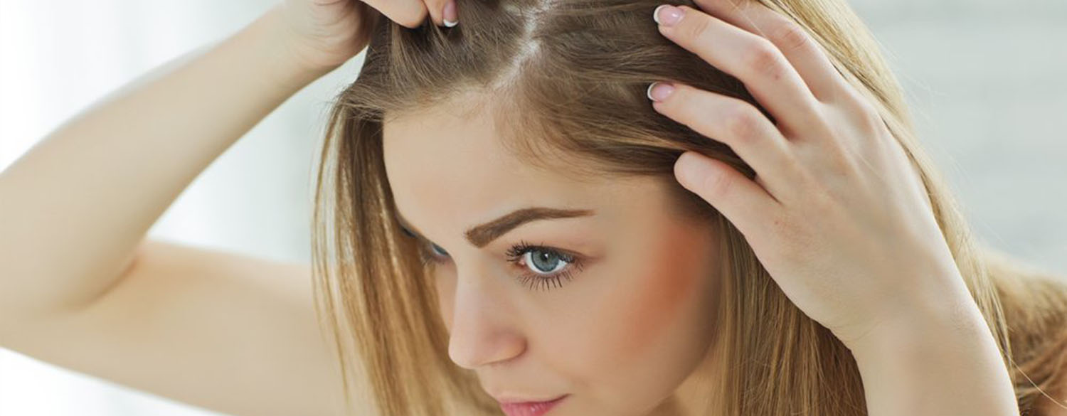 Выпадение волос по женскому типу - андрогенная алопеция